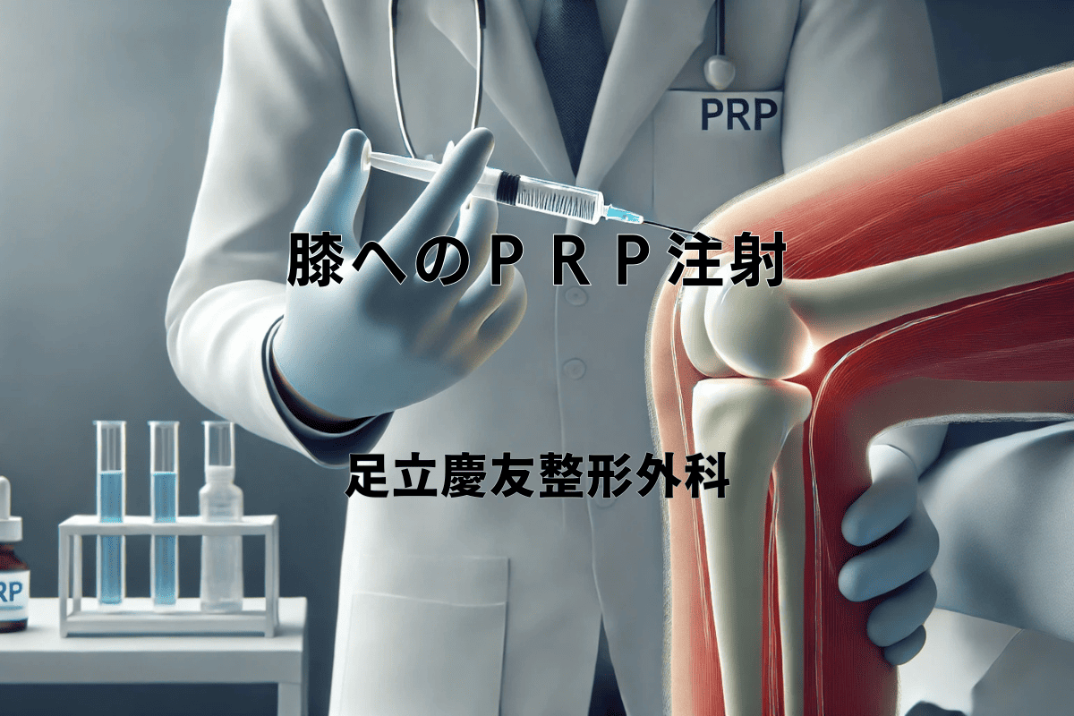 PRP注射 – 膝の痛みに向き合う治療法